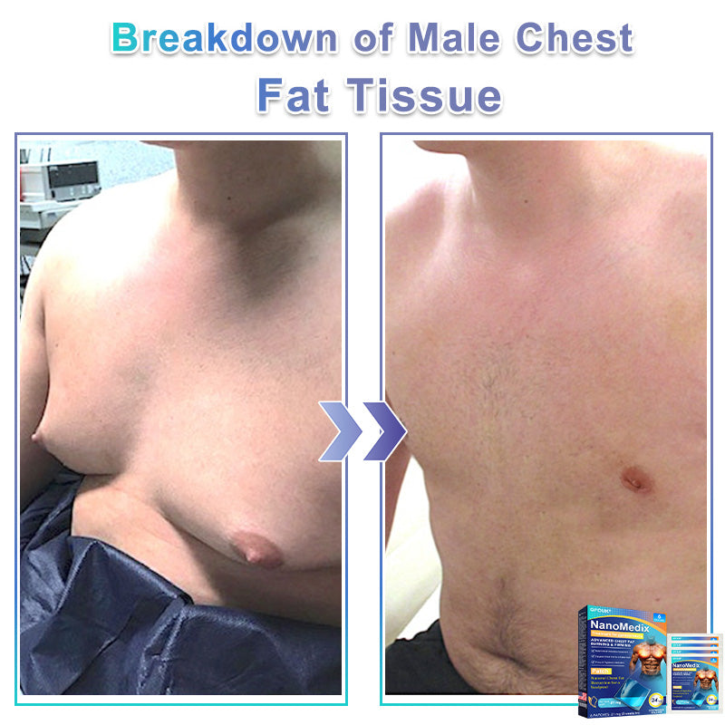 ⚕️GFOUK® NanoMedix Gynecomastia Chest Fatburn & Firm Patch